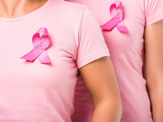 Tumore al seno nelle giovani donne: riduzione delle recidive con terapia ormonale prolungata oltre i 5 anni